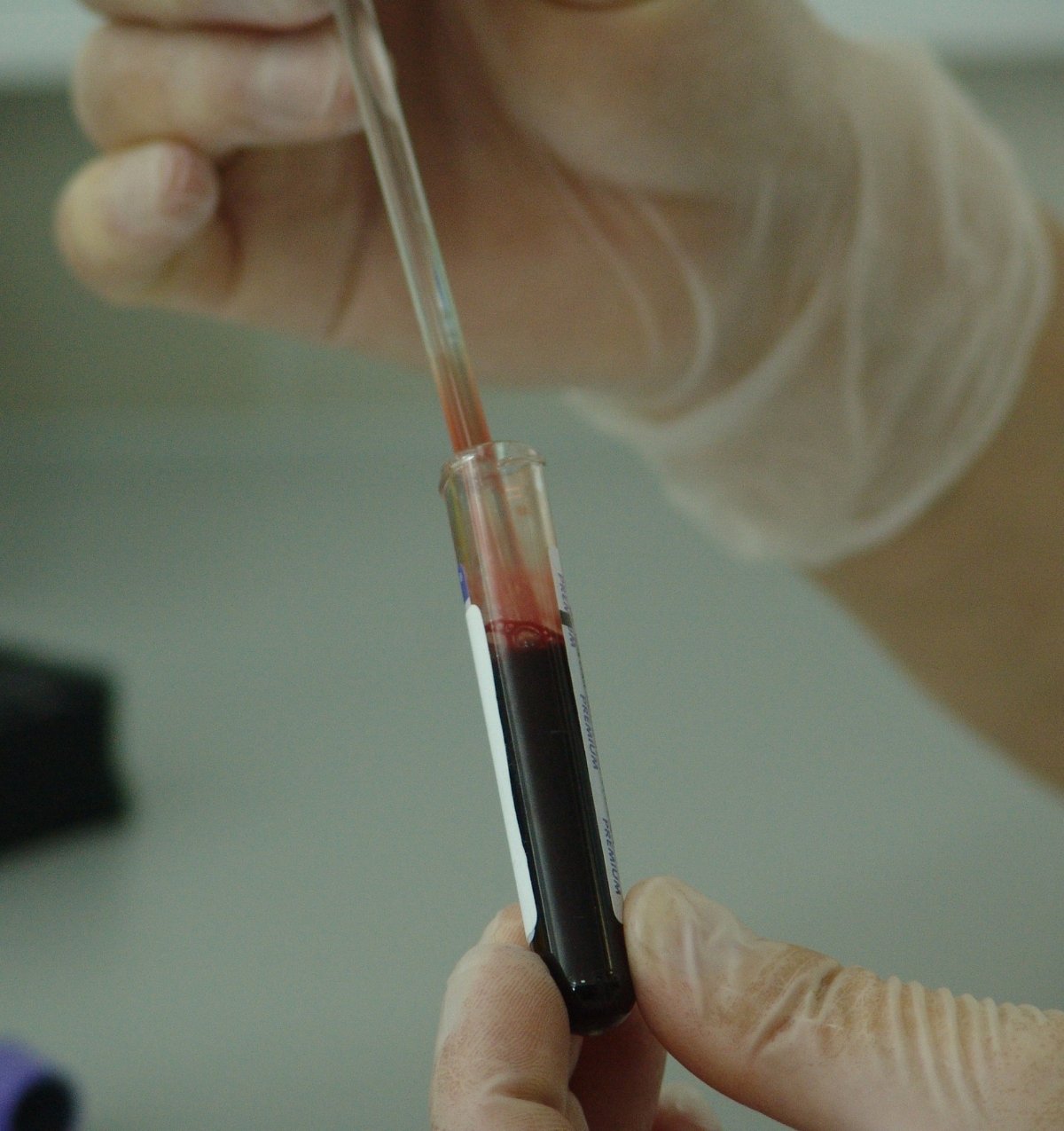 Bloodwork Analysis